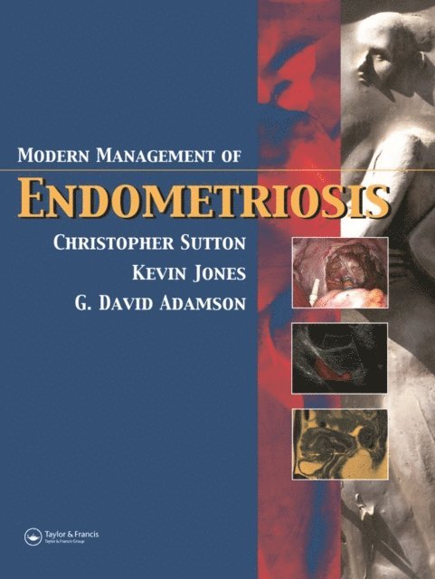Kevin D. Jones, G. David Adamson, Christopher Sutton - Modern Management of Endometriosis, E-bok