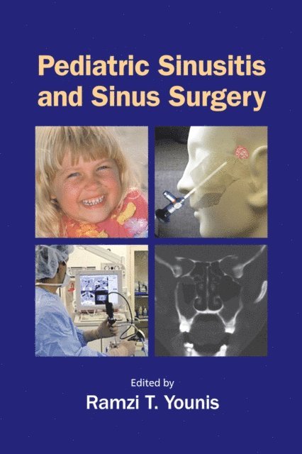 Ramzi T. Younis - Pediatric Sinusitis and Sinus Surgery, E-bok. Tillgänglighet: Lägg i varukorg