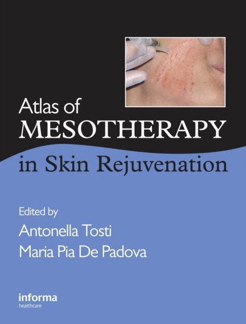 Maria Pia De Padova, Antonella Tosti - Atlas of Mesotherapy in Skin Rejuvenation, E-bok