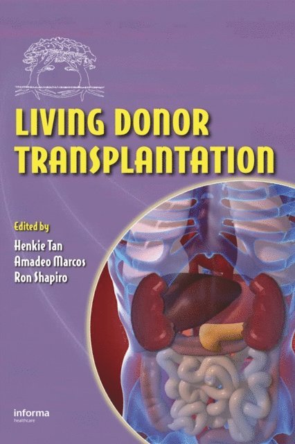 Ron Shapiro, Amadeo Marcos, Henkie P. Tan - Living Donor Transplantation, E-bok