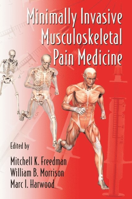 Marc I. Harwood, William B. Morrison MD, Mitchell Freedman - Minimally Invasive Musculoskeletal Pain Medicine, E-bok