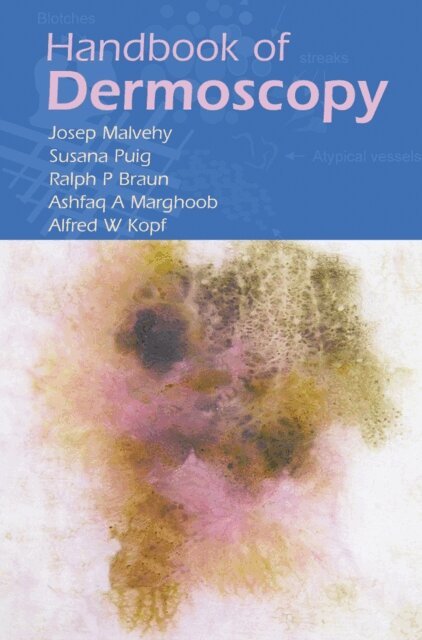 Alfred W. Kopf, Ashfaq A. Marghoob, Susana Puig, Ralph P. Braun, Josep Malvehy - Handbook of Dermoscopy, E-bok
