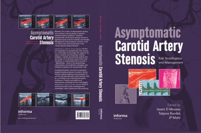 JP Mohr, Tatjana Rundek, Issam D. Moussa - Asymptomatic Carotid Artery Stenosis, E-bok