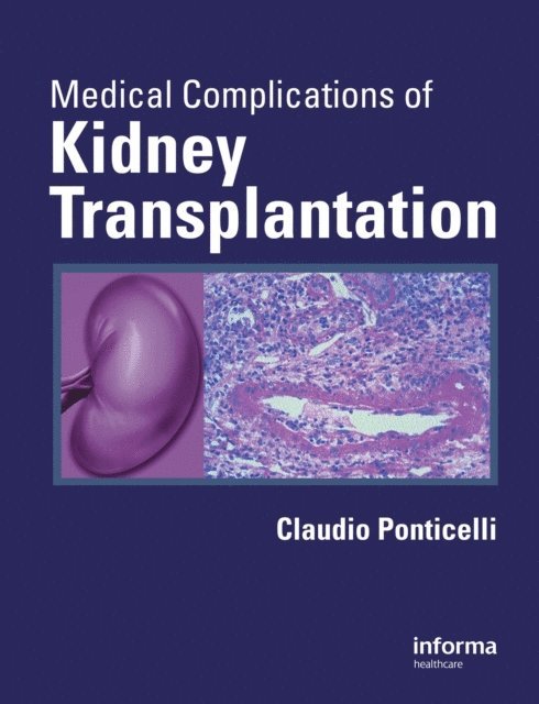 Claudio Ponticelli - Medical Complications of Kidney Transplantation, E-bok