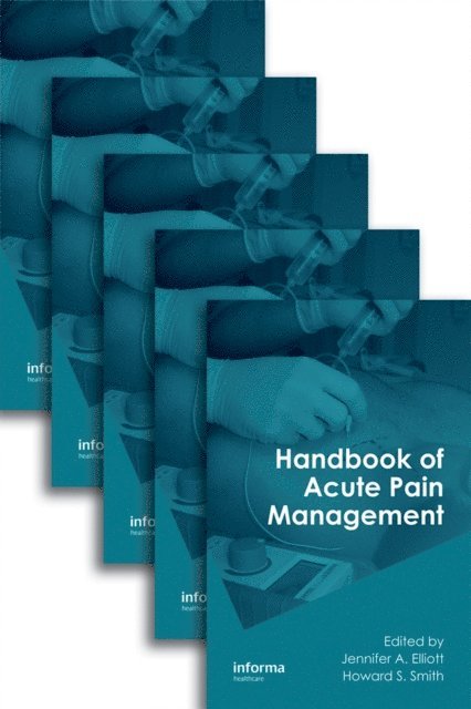 Howard S. Smith, Jennifer A. Elliott - Handbook of Acute Pain Management, E-bok