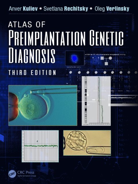 Oleg Verlinsky, Svetlana Rechitsky, Anver Kuliev - Atlas of Preimplantation Genetic Diagnosis, E-bok