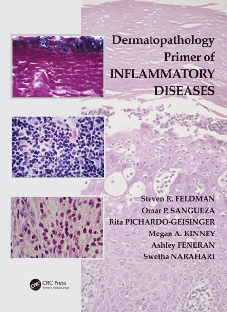 Swetha Narahari, Ashley Feneran, Megan Kinney, Rita Pichardo-Geisinger, Omar P. Sangueza, Steven R. Feldman - Dermatopathology Primer of Inflammatory Diseases, E-bok