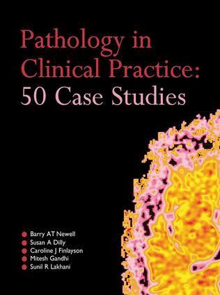 Barry AT Newell, Susan Dilly, Caroline Finlayson, Mitesh Gandhi, Sunil Lakhani - Pathology in Clinical Practice: 50 Case Studies, E-bok