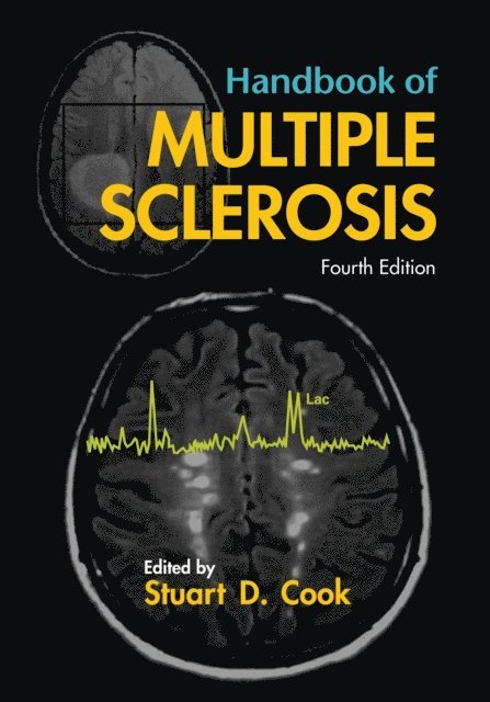 Stuart D. Cook - Handbook of Multiple Sclerosis, E-bok