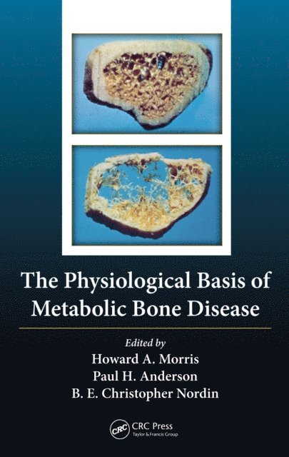 Paul Anderson, Howard Arthur Morris, Borje Edgar Christopher Nordin - Physiological Basis of Metabolic Bone Disease, E-bok