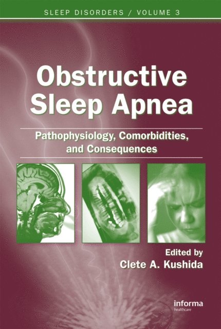 Clete A. Kushida - Obstructive Sleep Apnea: Pathophysiology, Comorbidities and Consequences, E-bok