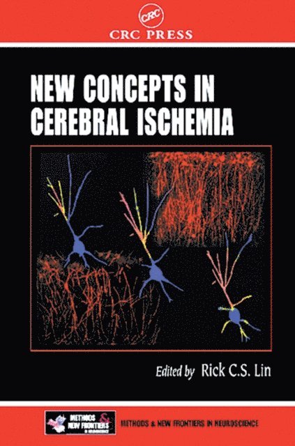 Rick C. S. Lin - New Concepts in Cerebral Ischemia, E-bok
