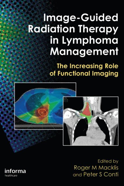 Peter S. Conti, Roger M. Macklis - Image-Guided Radiation Therapy in Lymphoma Management, E-bok