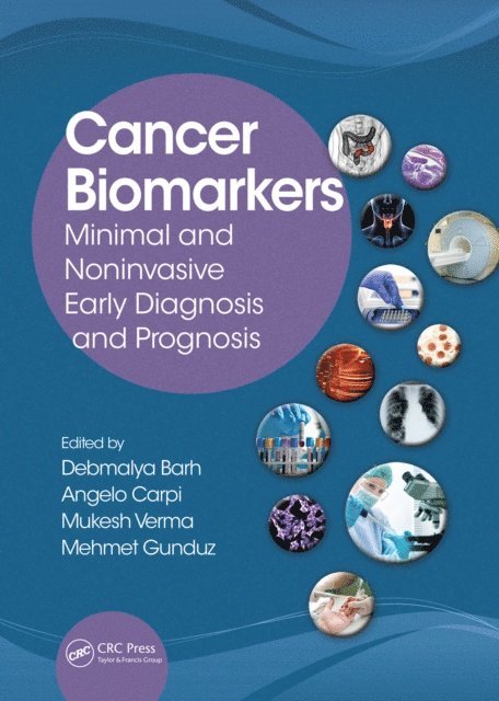 Mehmet Gunduz, Mukesh Verma, Angelo Carpi, Debmalya Barh - Cancer Biomarkers, E-bok