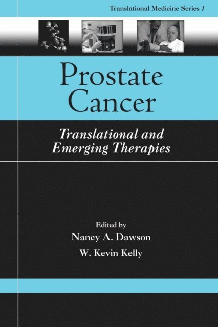 W. Kevin Kelly, Nancy A. Dawson - Prostate Cancer, E-bok