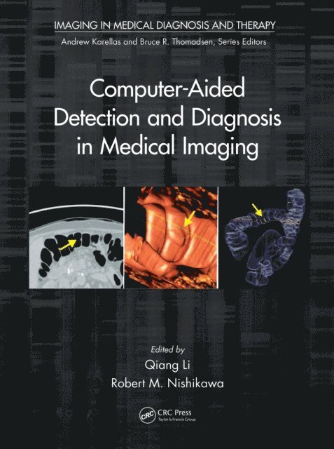 Robert M. Nishikawa, Qiang Li - Computer-Aided Detection and Diagnosis in Medical Imaging, E-bok