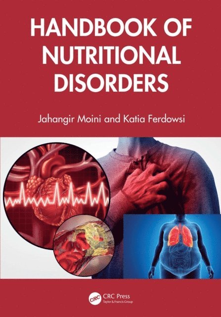Katia Ferdowsi, Jahangir Moini - Handbook of Nutritional Disorders, E-bok