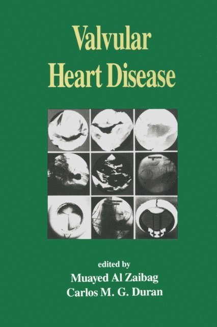 Carlos M. G. Duran, Muayed AI Zaibag - Valvular Heart Disease, E-bok