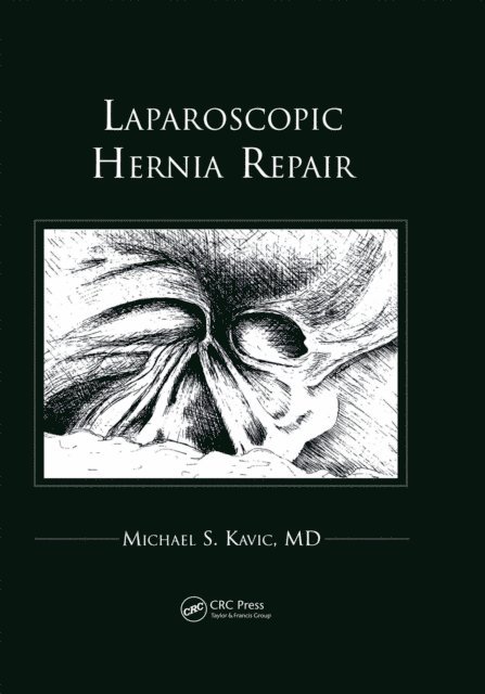 Michael S Kavic - Laparoscopic Hernia Repair, E-bok
