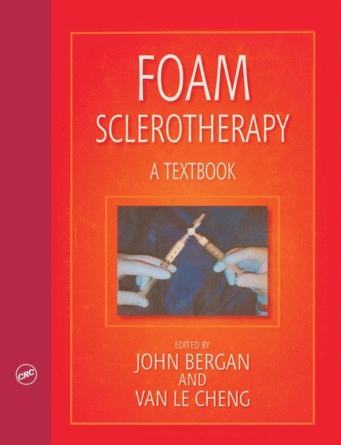 Van Le Cheng, John J. Bergan - Foam Sclerotherapy: A Textbook, E-bok