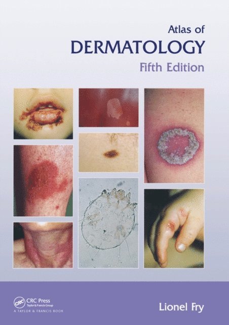 Lionel Fry - Atlas of Dermatology, Fifth Edition, E-bok