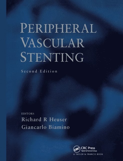 Giancarlo Biamino, Richard R. Heuser - Peripheral Vascular Stenting, Second Edition, E-bok