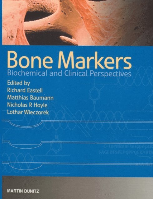 Lothar Wieczorek, Nicholas Hoyle, Richard Eastell, Matthias Baumann - Bone Markers, E-bok