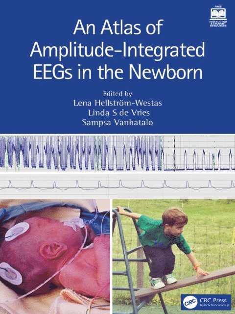 Sampsa Vanhatalo, Linda S de Vries, Lena Hellstrom-Westas - Atlas of Amplitude-Integrated EEGs in the Newborn, E-bok