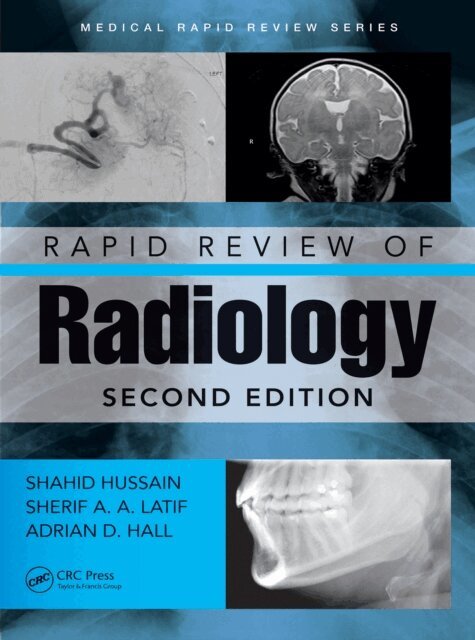 Adrian David Hall, Sherif Aaron Abdel Latif, Shahid Hussain - Rapid Review of Radiology, E-bok