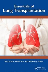 Essentials of Lung Transplantation