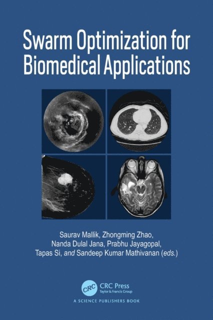 Sandeep Kumar Mathivanan, Tapas Si, Prabhu Jayagopal, Nanda Dulal Jana, Zhongming Zhao, Saurav Mallik - Swarm Optimization for Biomedical Applications, E-bok