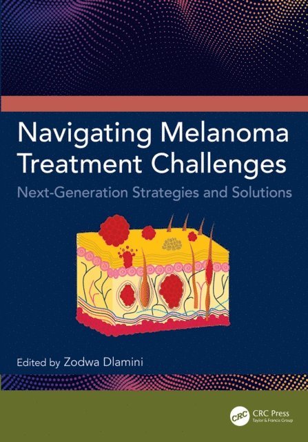 Zodwa Dlamini - Navigating Melanoma Treatment Challenges, E-bok