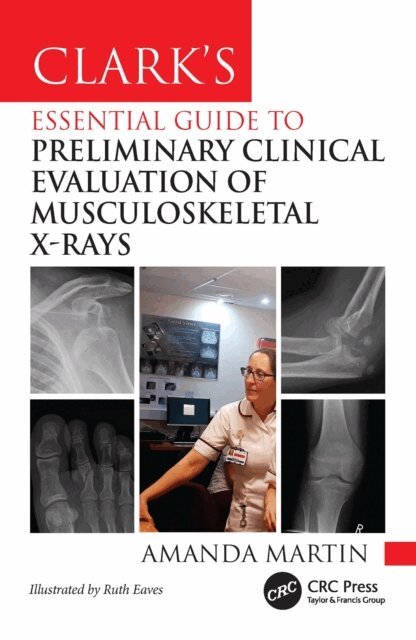 Amanda Martin - Clark's Essential Guide to Preliminary Clinical Evaluation of Musculoskeletal X-rays, E-bok