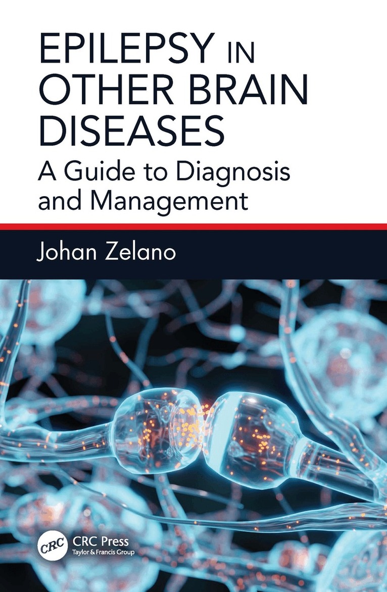 Johan Zelano - Epilepsy in Other Brain Diseases, E-bok