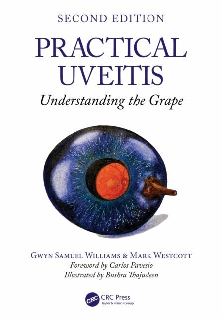 Mark Westcott, Gwyn Samuel Williams - Practical Uveitis, E-bok