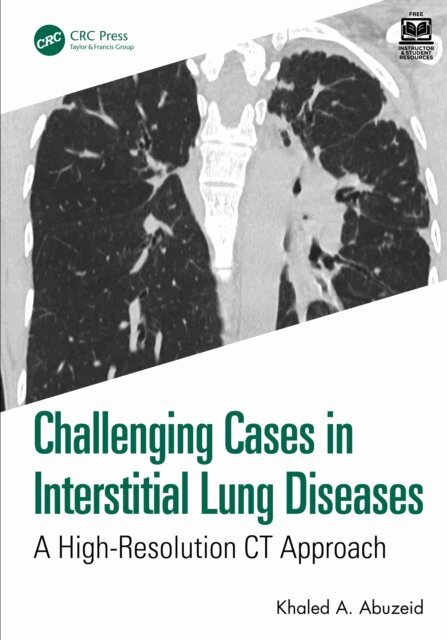 Khaled A. Abuzeid - Challenging Cases in Interstitial Lung Diseases, E-bok
