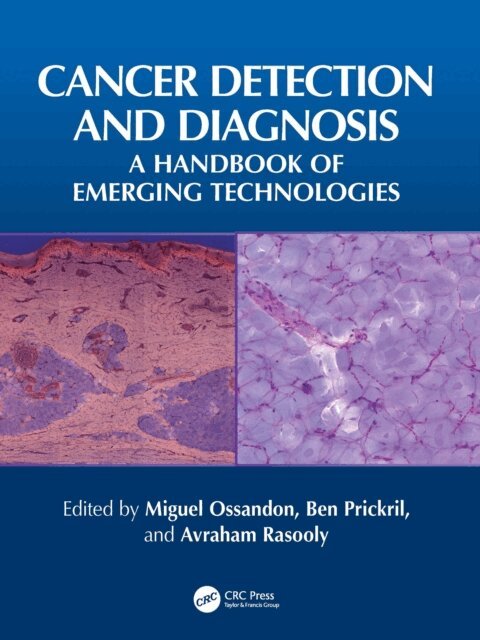Avraham Rasooly, Ben Prickril, Miguel Ossandon - Cancer Detection and Diagnosis, E-bok