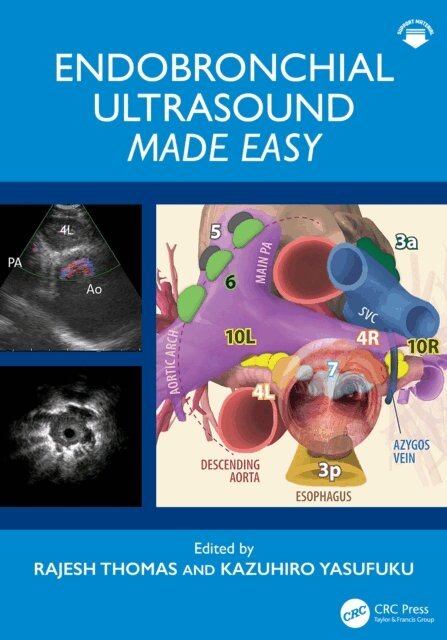 Kazuhiro Yasufuku, Rajesh Thomas - Endobronchial Ultrasound Made Easy, E-bok