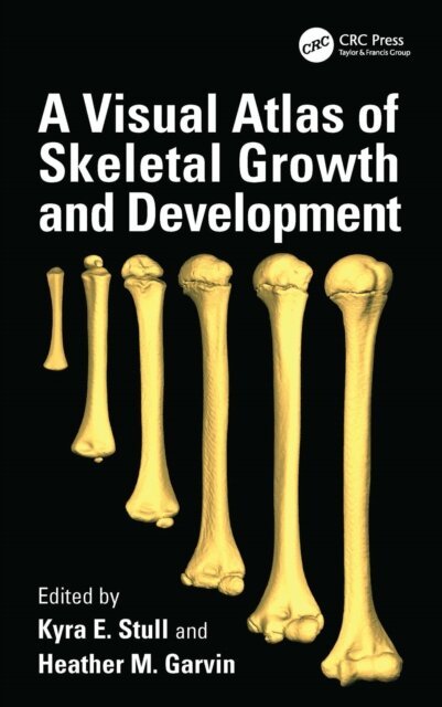 Heather M. Garvin, Kyra E. Stull - Visual Atlas of Skeletal Growth and Development, E-bok