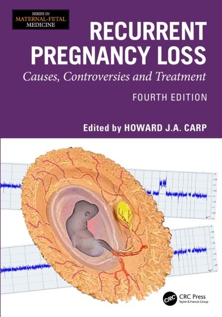 Howard J A Carp - Recurrent Pregnancy Loss, E-bok