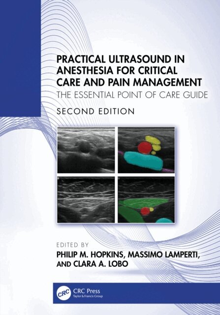 Clara A Lobo, Massimo Lamperti, Philip M Hopkins - Practical Ultrasound in Anesthesia for Critical Care and Pain Management, E-bok