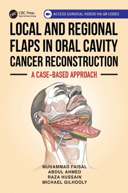 Michael Gilhooly, Raza Hussain, Abdul Ahmed, Muhammad Faisal - Local and Regional Flaps in Oral Cavity Cancer Reconstruction, E-bok