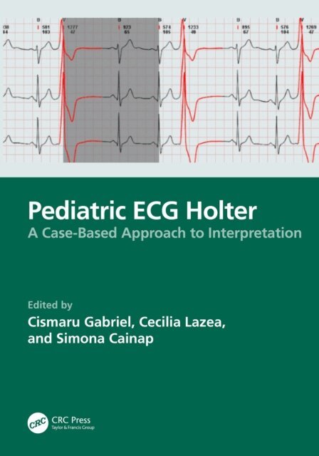 Simona Cainap, Cecilia Lazea, Cismaru Gabriel - Pediatric ECG Holter, E-bok