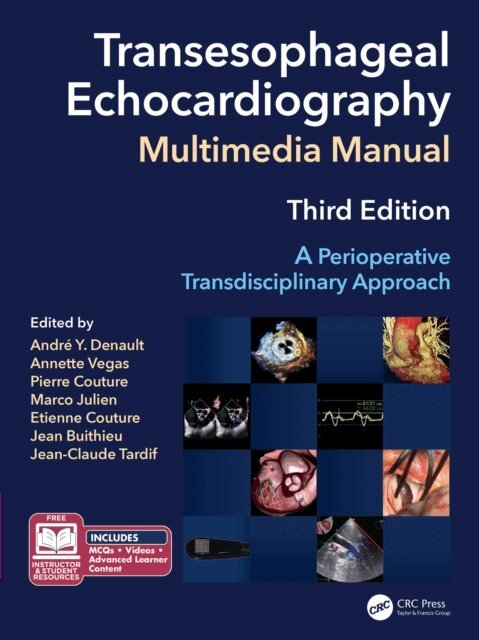Jean-Claude Tardif, Jean Buithieu, Etienne Couture, Marco Julien, Pierre Couture, Annette Vegas, Andre Y. Denault MD PhD - Transesophageal Echocardiography Multimedia Manual, E-bok