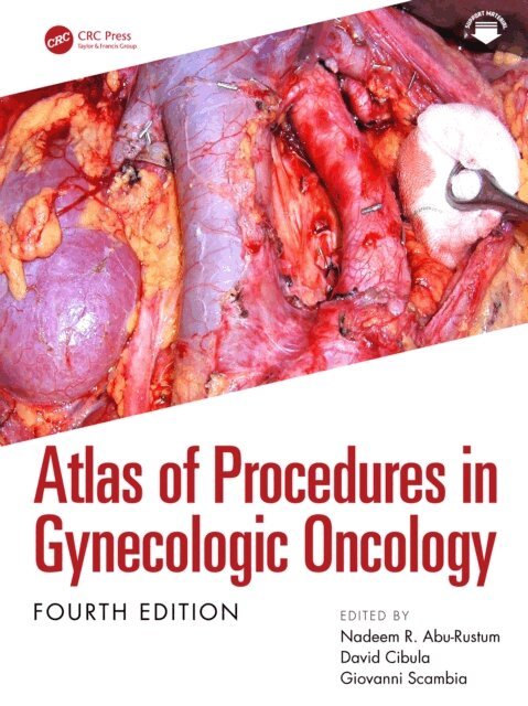Giovanni Scambia, David Cibula, Nadeem R. Abu-Rustum - Atlas of Procedures in Gynecologic Oncology, E-bok