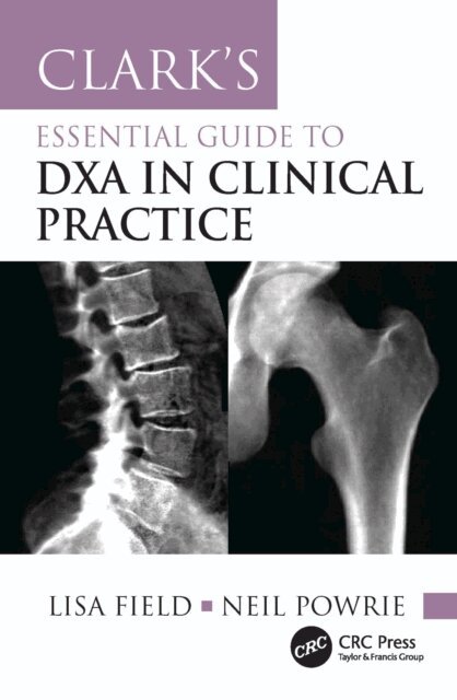 Neil Powrie, Lisa Field - Clark's Essential Guide to DXA in Clinical Practice, E-bok