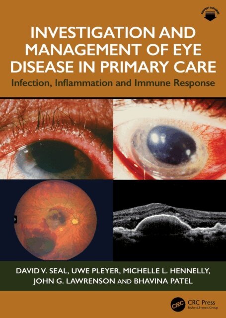 Bhavina Patel, John G. Lawrenson, Michelle L. Hennelly, Uwe Pleyer, David V. Seal - Investigation & Management of Eye Disease in Primary Care, E-bok