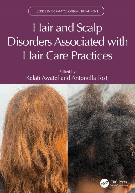 Antonella Tosti, Kelati Awatef - Hair and Scalp Disorders Associated with Hair Care Practices, E-bok