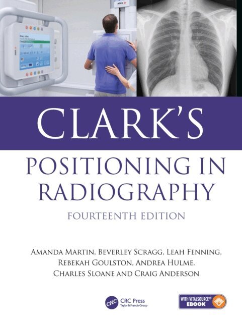 Craig Anderson, Charles Sloane, Andrea Hulme, Rebekah Goulston, Leah Fenning, Beverley Scragg, Amanda Martin - Clark's Positioning in Radiography, E-bok. Tillgänglighet: Kommande
