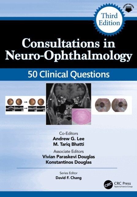 M. Tariq Bhatti, Andrew Lee - Consultations in Neuro-Ophthalmology, E-bok